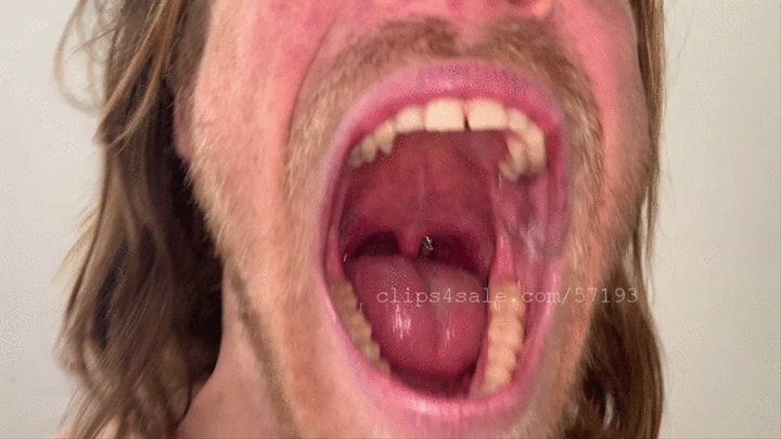 Honey reccomend mouth uvula tongue teeth checks endoscope