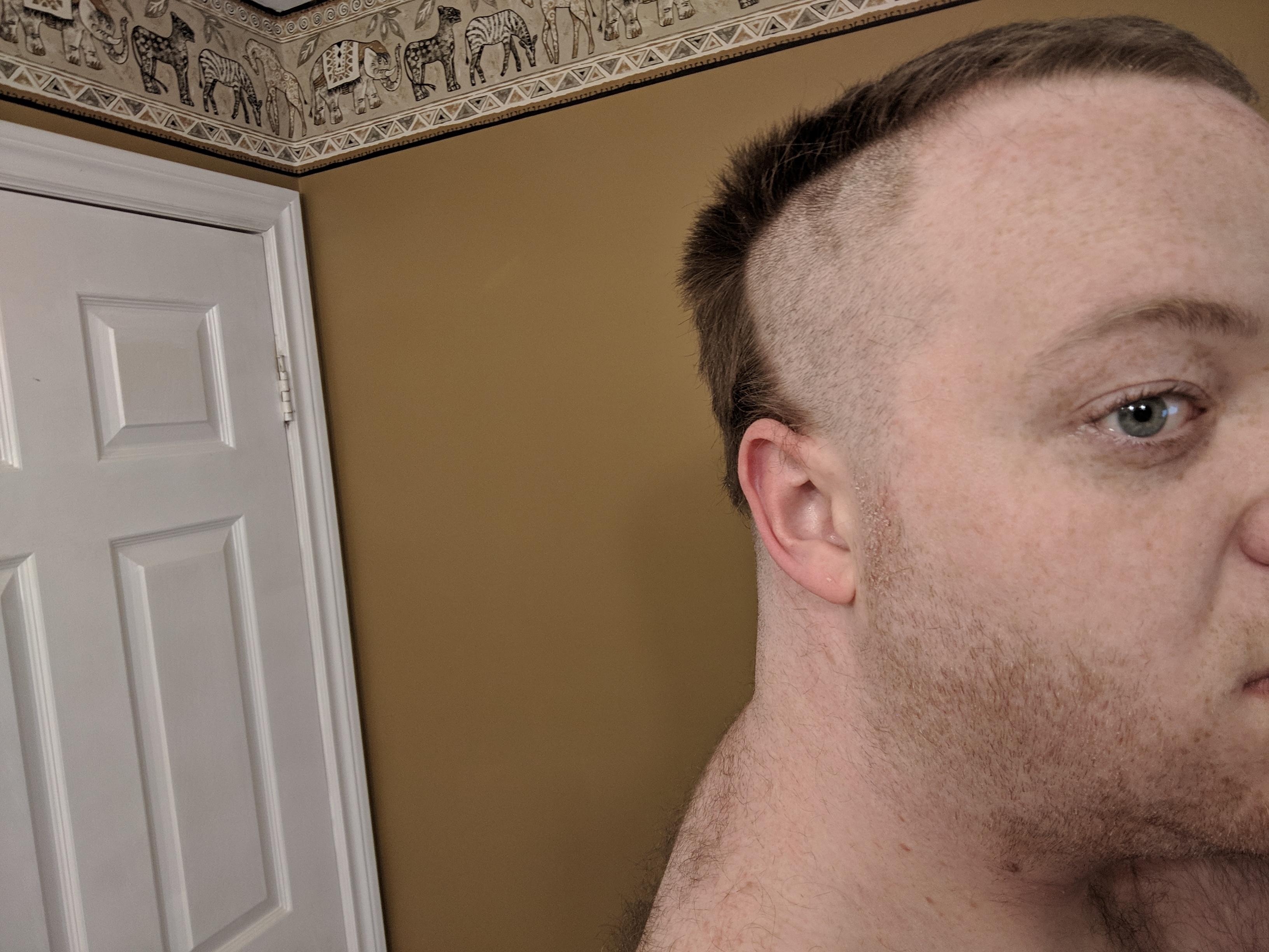 Clipper shaving husband bald