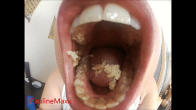 Mouth uvula tongue teeth checks endoscope
