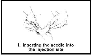 Injecting large dose speed