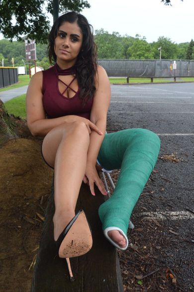 best of Woman broken blonde cast with ankle