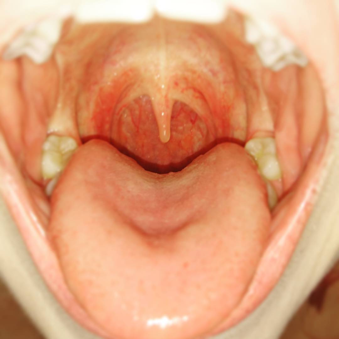 best of Instagram girl with cute uvula playing