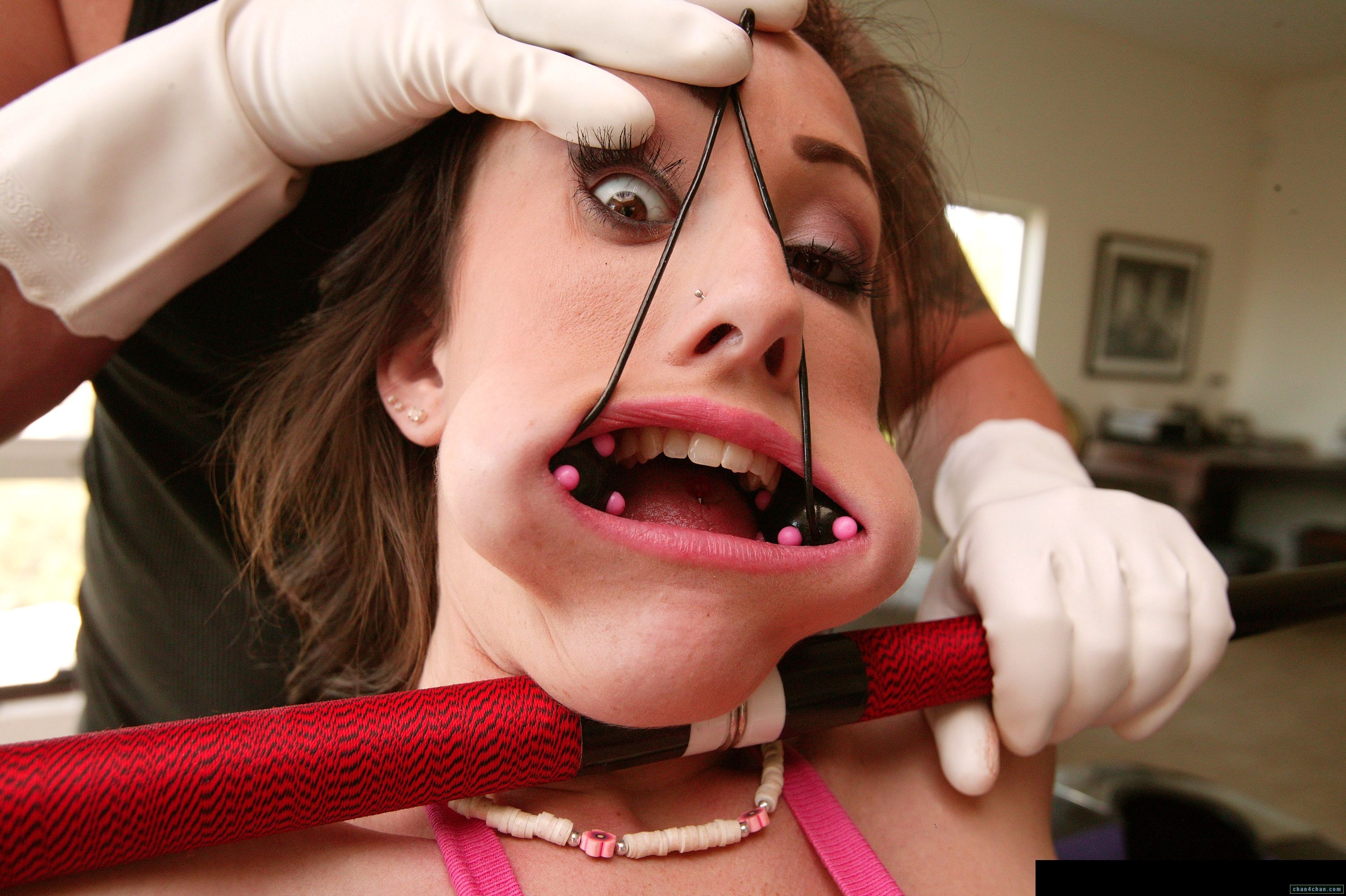 Sparkles reccomend dentist fetish torture female patient